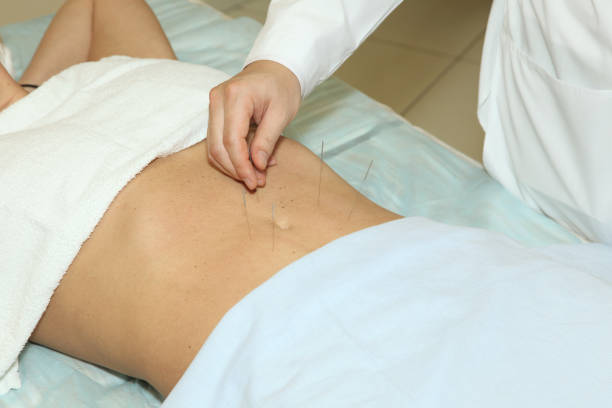 Acupuncture For Weight Loss